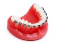 Who Can Benefit from Orthodontics in Chanhassen, MN?