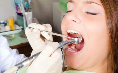 Finding Relief from Tooth Pain with a Trusted Dentist in Little Rock AR